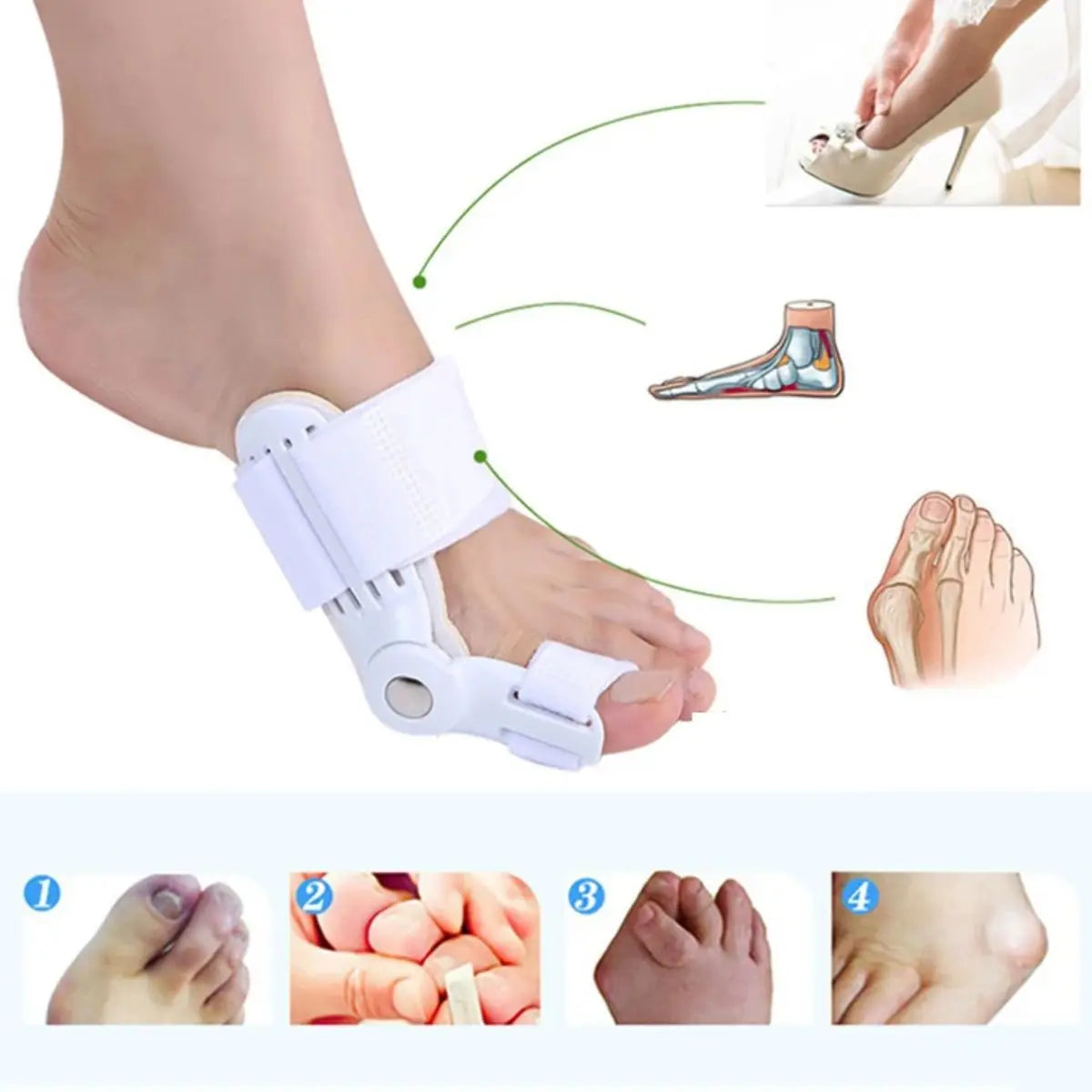 Correcteur d'Hallux Valgus
